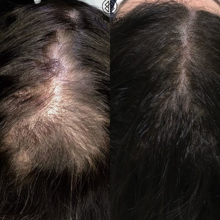 RADISH HAIR OIL   (  50%OFF  )